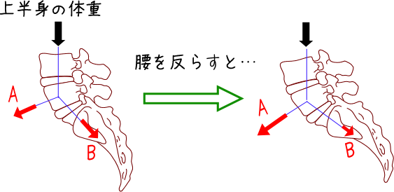 分離症・すべり症の原因説明図