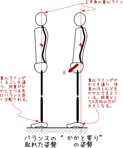 分離症・すべり症にならないための姿勢