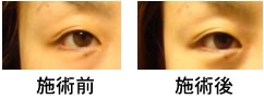 目の周りの変化