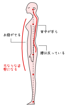 反りすぎの姿勢