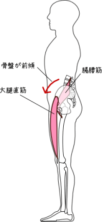 骨盤の前傾に関連する筋肉