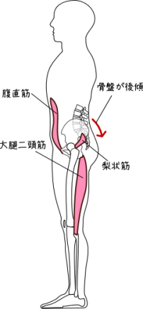 骨盤の後傾に関連する筋肉
