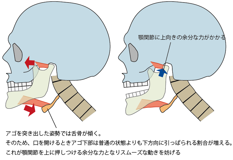 猫背な人のアゴの動き